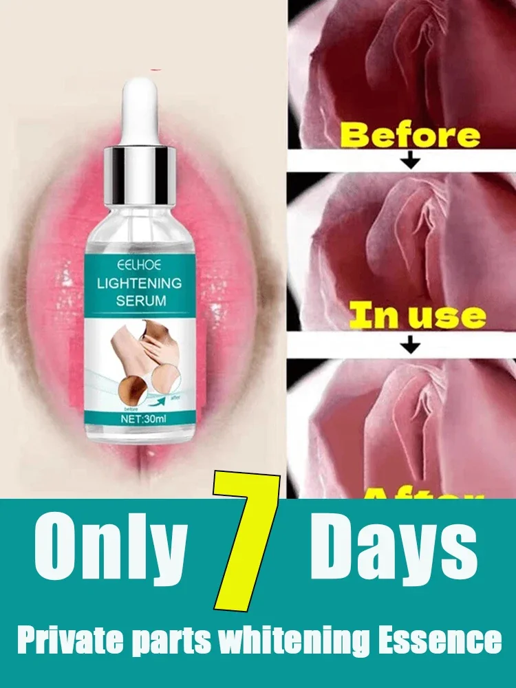 Perfume Zara - سيروم تبييض البشرة للأجزاء الخاصة ،